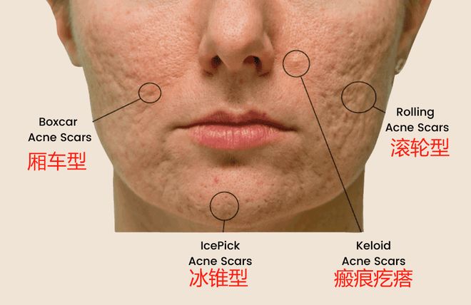 关于I?8Y塄k~€痘猸W?6N???t%K%?徏j獳S憣?的信息